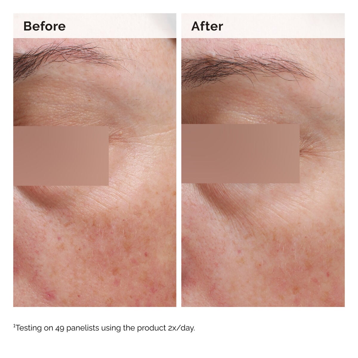 5% Face and Body Emulsion - Fresh Routine