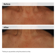 5% Face and Body Emulsion - Fresh Routine