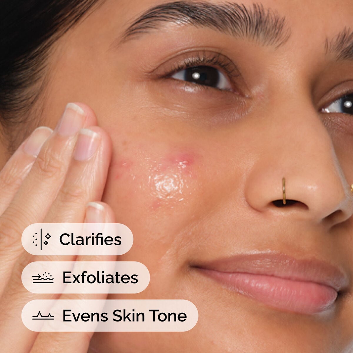 Acid 2% Anhydrous Solution - Skin Support