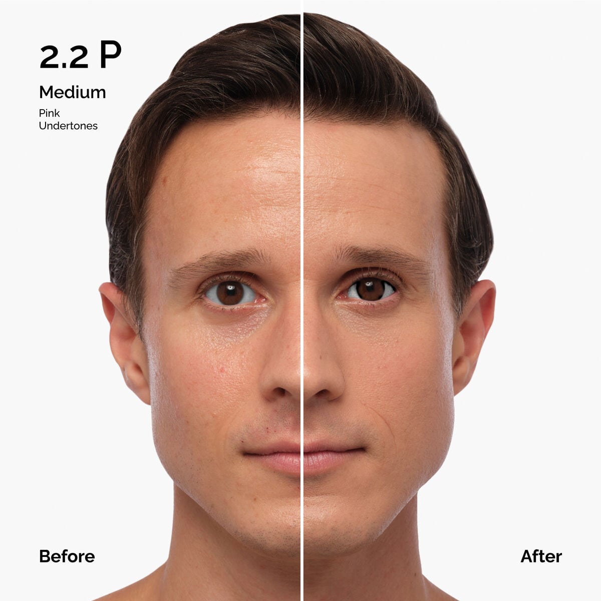 Serum - 1.0-n - 30ml - Smooth Finish