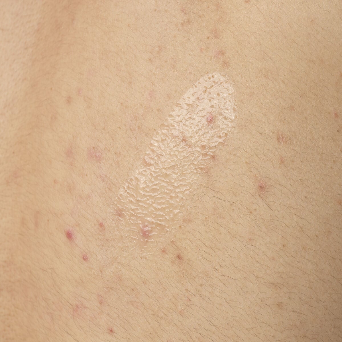 Acid 0.5% Body Serum - Ready Look