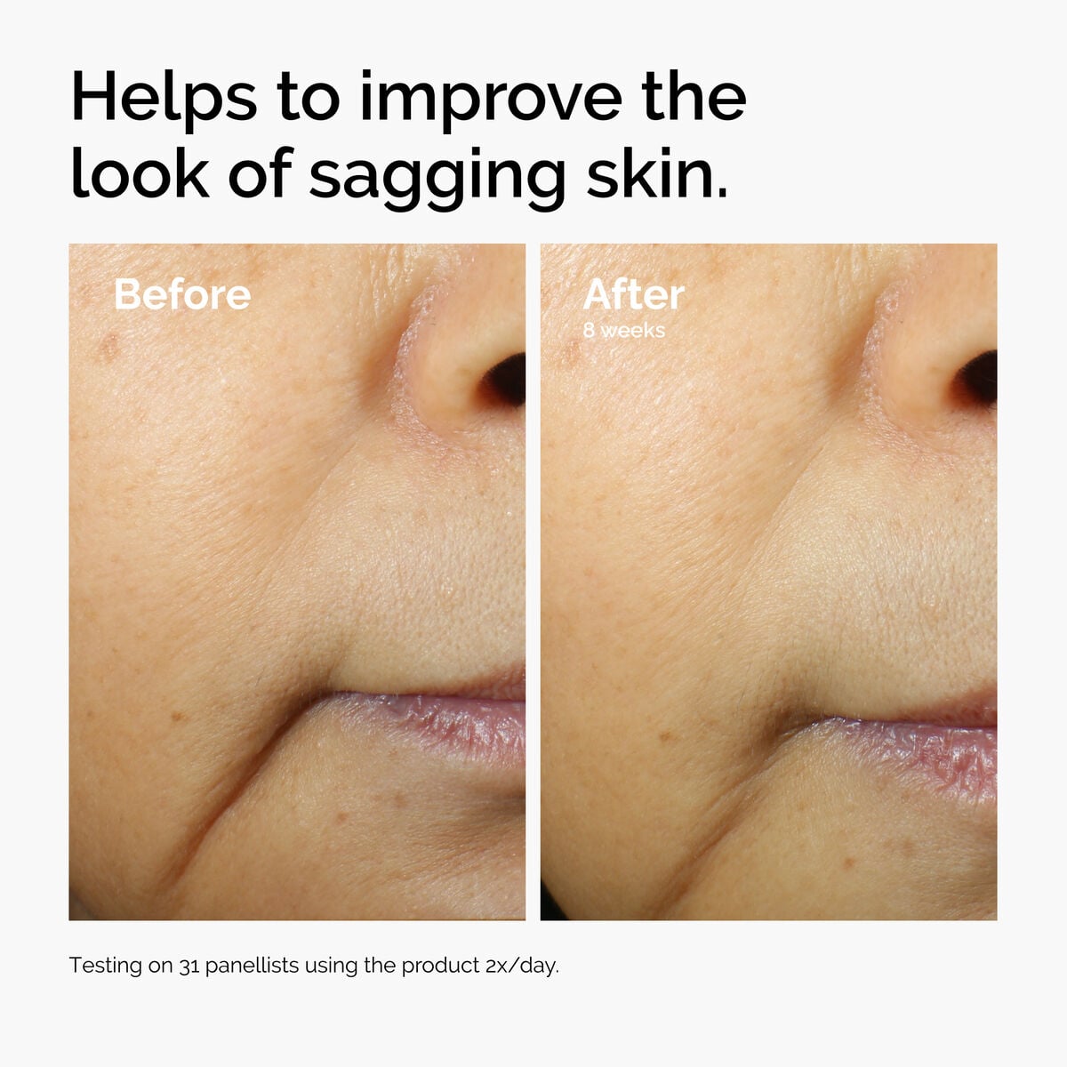 3% + Escin 1% Face Serum - Daily Glow