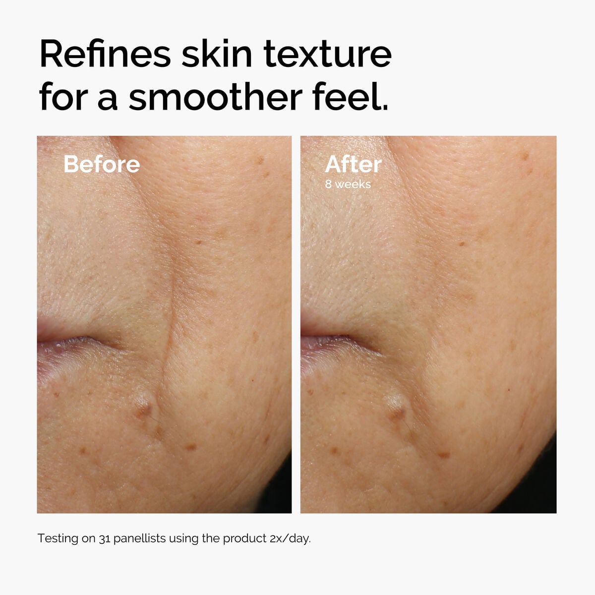 3% + Escin 1% Face Serum - Daily Glow