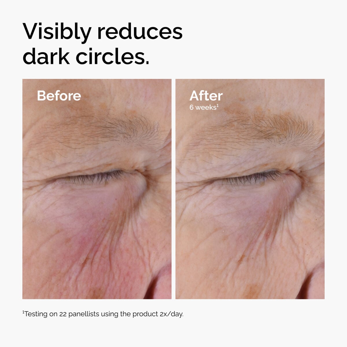 5% + EGCG Eye Serum - Easy Set