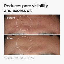 10% + Zinc 1% - Easy Routine