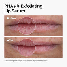PHA 5% Exfoliating Lip Serum - Easy Blend