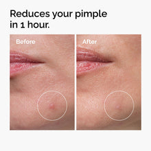 Sulfur 10% Powder-to-Cream Concentrate - Fresh Reset